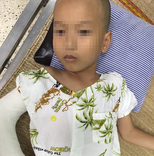 Cứu sống bé trai 7 tuổi đa chấn thương do ngã từ độ cao 8m
