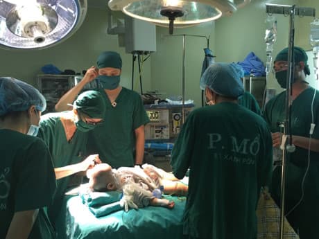 Phẫu thuật thành công em bé bị dị dạng hộp sọ hiếm gặp