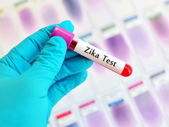 TP Hồ Chí Minh: Phát hiện 17 trường hợp nhiễm vi rút Zika