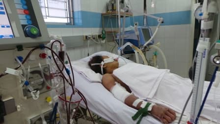 Bình Định: Sốt xuất huyết xuất hiện trên diện rộng, có thêm một ca tử vong