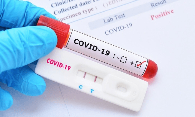 Cần quyết liệt đưa kit test Covid-19 vào diện bình ổn giá