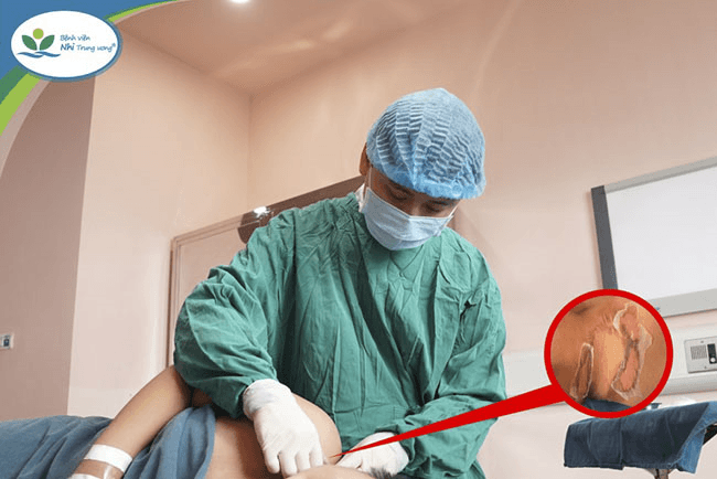 Tết Nguyên đán: Gia tăng tai nạn sinh hoạt ở trẻ em